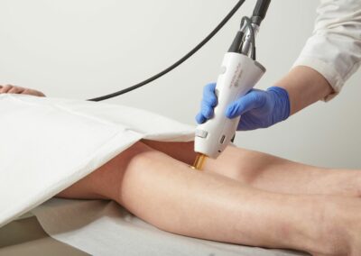 Epilation laser